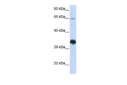 ZNF630 Rabbit anti-Human, Polyclonal, Novus Biologicals 0.1 mL | Buy Online | Novus Biologicals | Fisher Scientific